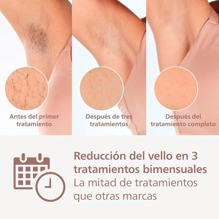 PHILIPS LUMEA PRESTIGE DEPILADORA IPL, LUZ PULSADA, CON CABLE, 4 CABEZALES INTELIGENTES (CUERPO, BIKINI, AXILAS Y CARA) Y SMARTSKIN SENSOR, BRI947/50 BLANCO GRADO B