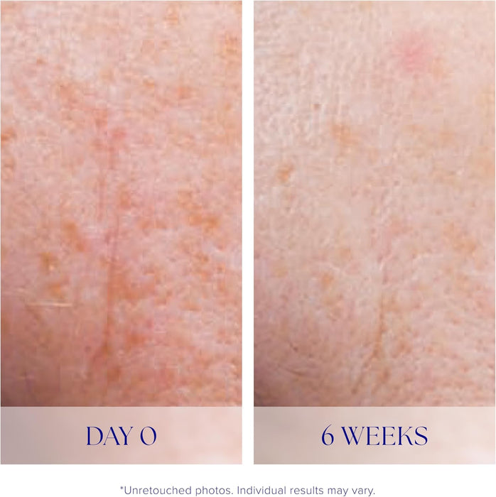 IS CLINICAL ACTIVE SERUM, 0.5 FL. OZ. GRADO B