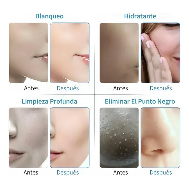 7 En 1 Maquina Facial Led Instruments De Beauty De Oxi­geno